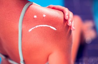Troppo sole?! Niente paura!