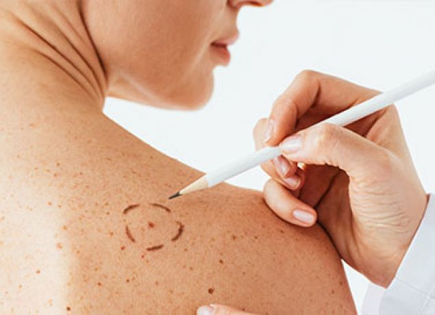 Check-up Dermatologico 